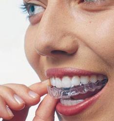 invisalign